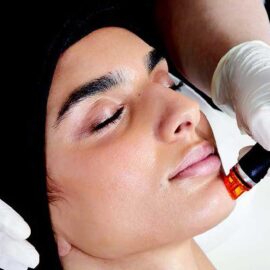 Hydrafacial