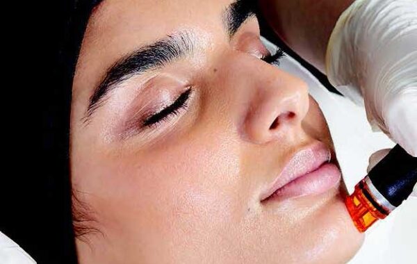 Hydrafacial